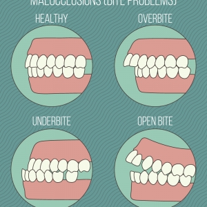 Does the malocclusion (bite problems) effect your daily life?