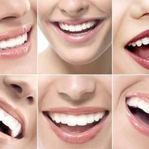 Whiten your teeth easily with DIY