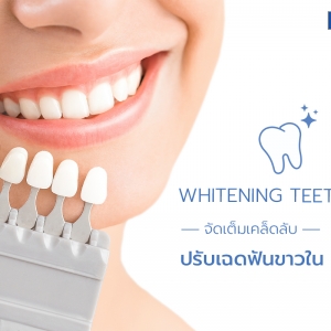 Whitening Teeth Tip จัดเต็มเคล็ดลับปรับเฉดฟันขาวใน 7 วัน !